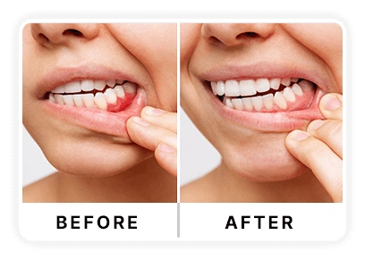 DentaVive Oral Health Supplement Bottle